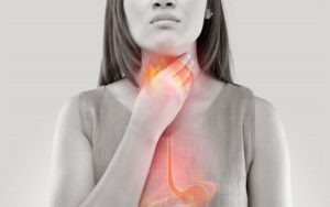 Víte, co je kyselý reflux? Stav, při kterém se obsah žaludku vrací zpět do jícnu, hrdla nebo úst. Účinnou pomoc nabízí zdravotnický prostředek Silicolgel.